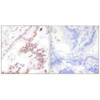 EP300 Antibody
