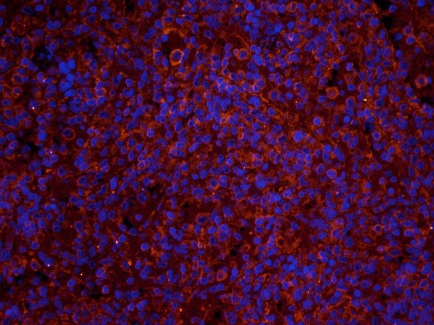 EPAS1 antibody