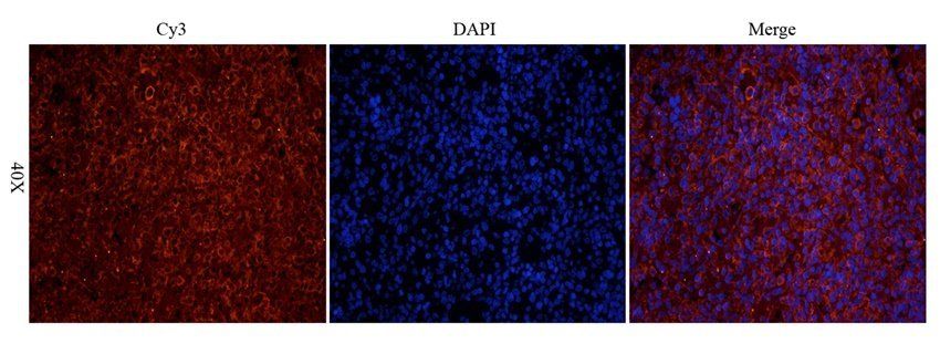 EPAS1 antibody