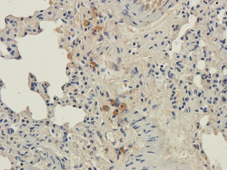 EPAS1 antibody