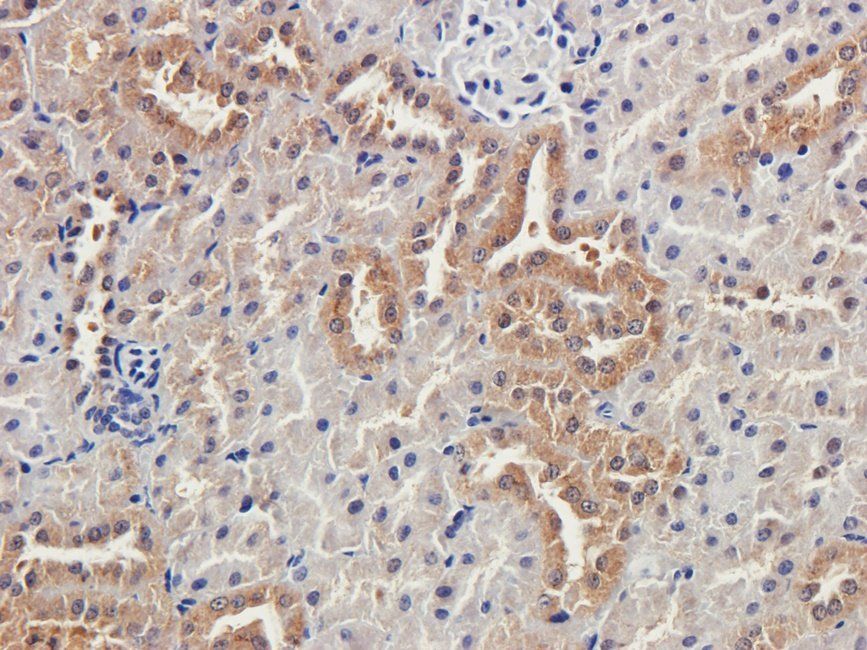 EPAS1 antibody