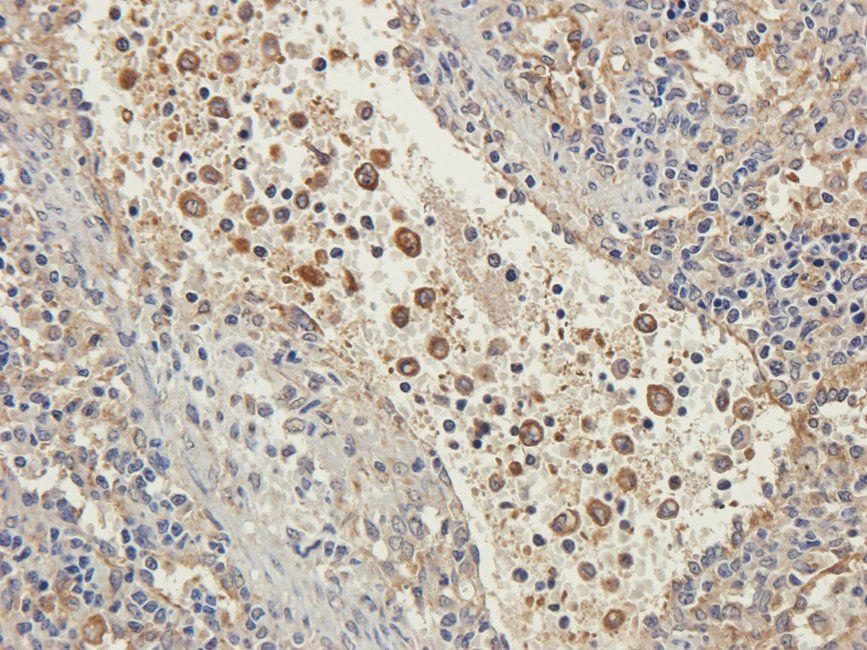 EPAS1 antibody