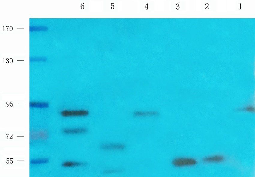 EPAS1 antibody