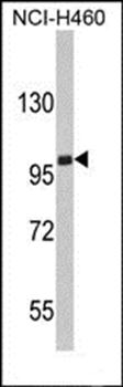 EPB41L4B antibody