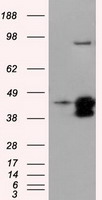 EPCAM Antibody