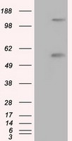 EPCAM Antibody
