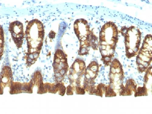 Ep-CAM / CD326 (Cytoplasmic Domain) (Epithelial Marker) Antibody