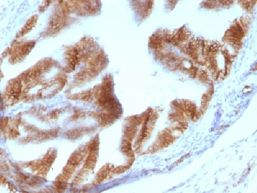 Ep-CAM / CD326 (Cytoplasmic Domain) (Epithelial Marker) Antibody