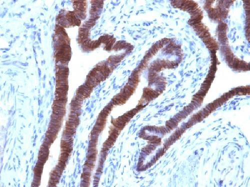 Ep-CAM / CD326 (Cytoplasmic Domain) (Epithelial Marker) Antibody