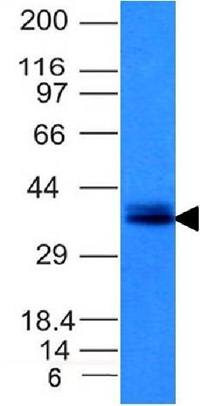 Ep-CAM / CD326 (Extracellular Domain) (Epithelial Marker) Antibody
