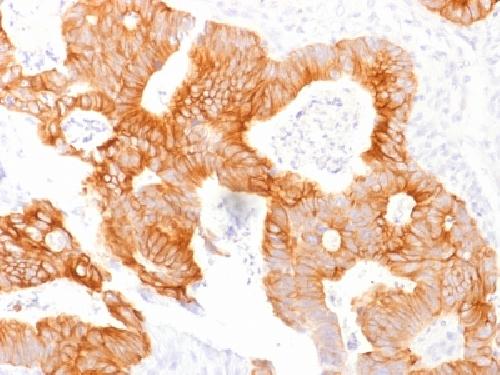 EPCAM Antibody