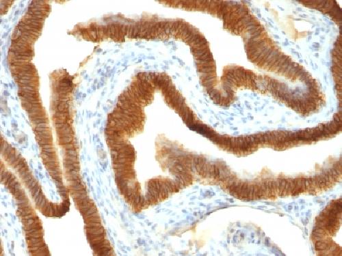 EpCAM / CD326 (Epithelial Marker) Antibody