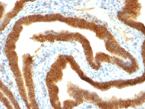 EpCAM / CD326 (Epithelial Marker) Antibody