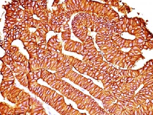 EPCAM Antibody