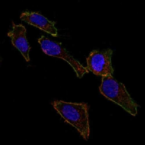 EpCAM antibody