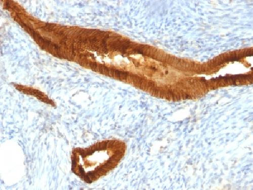 EpCAM antibody