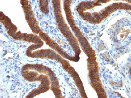 Ep-CAM / CD326 (Extracellular Domain) (Epithelial Marker) Antibody