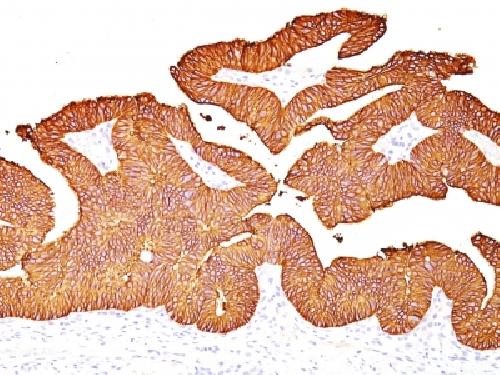 Ep-CAM / CD326 (Extracellular Domain) (Epithelial Marker) Antibody