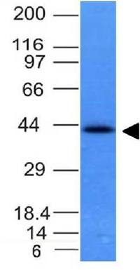 Ep-CAM / CD326 (Extracellular Domain) (Epithelial Marker) Antibody