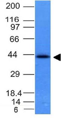 EpCAM antibody