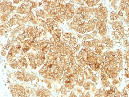 EpCAM antibody