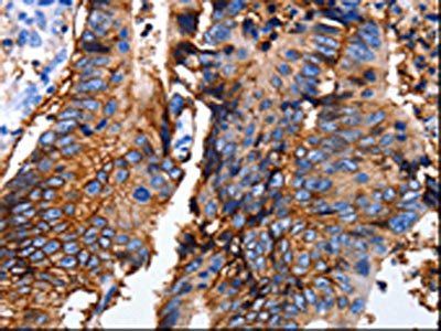 EPCAM Antibody