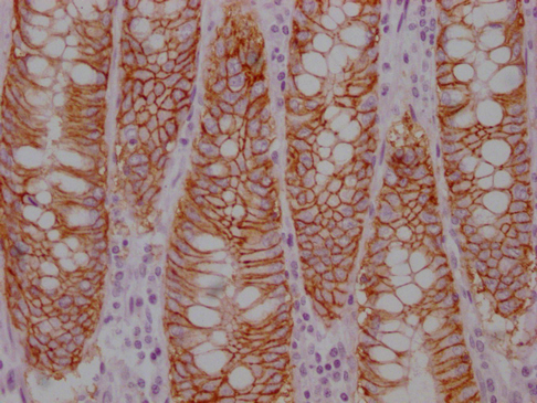 EPCAM Antibody
