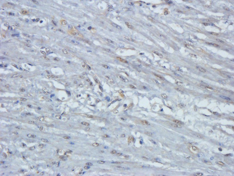 EpCAM antibody