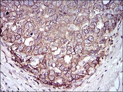 EPCAM Antibody