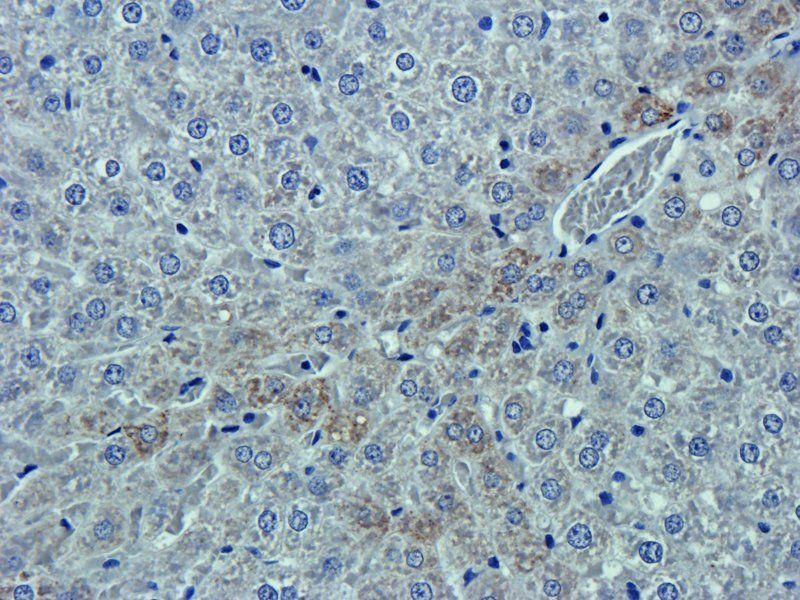 EpCAM antibody