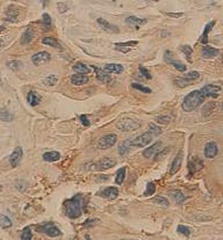 EpCAM Rabbit Polyclonal Antibody