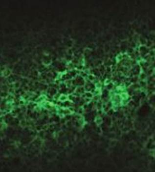 EpCAM Monoclonal Antibody