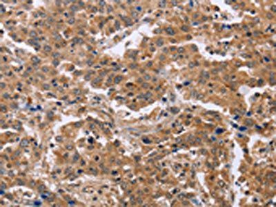 EPDR1 Antibody