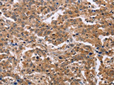 EPDR1 antibody