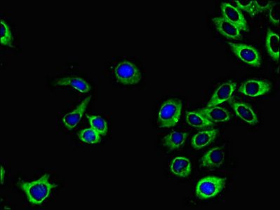 EPHA1 antibody