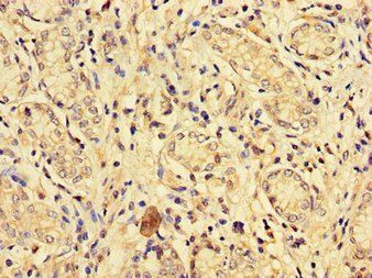 EPHA1 Antibody