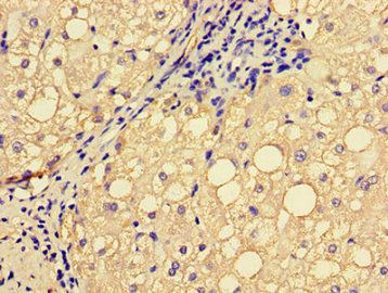 EPHA1 Antibody