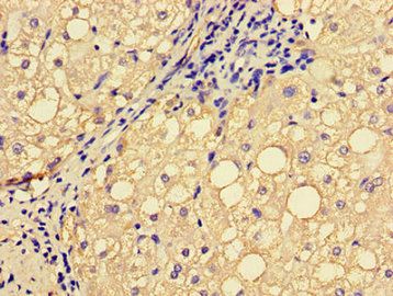 EPHA1 antibody