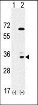 EPHA10 antibody
