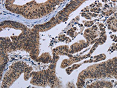 EPHA10 Antibody
