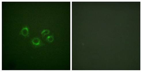 EPHA2/3/4 (Ab-588/596) Antibody