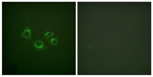 EPHA2/3/4 antibody