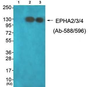 EPHA2/3/4 antibody