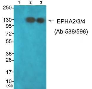 EPHA2/3/4 (Ab-588/596) Antibody