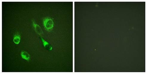 EPHA2/3 (phospho-Tyr588/596) antibody