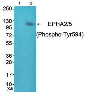 EPHA2/5 (Phospho-Tyr594) Antibody
