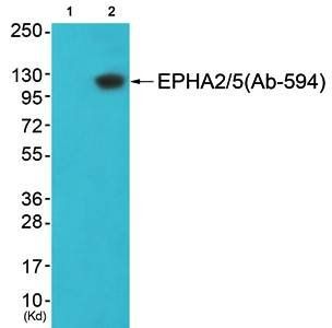 EPHA2/5 (Ab-594) Antibody