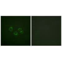 EPHA2/EPHA3/EPHA4 (Ab-588/596) Antibody