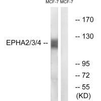 EPHA2 (Ab-588/596) antibody