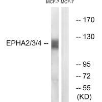 EPHA2/EPHA3/EPHA4 (Ab-588/596) Antibody
